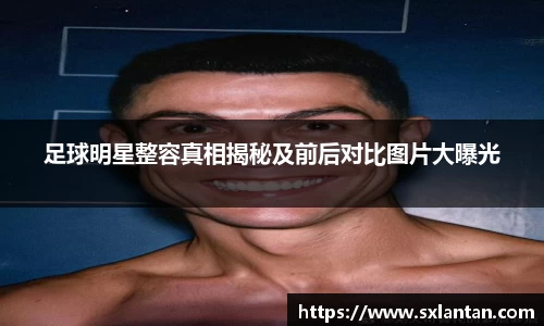 足球明星整容真相揭秘及前后对比图片大曝光